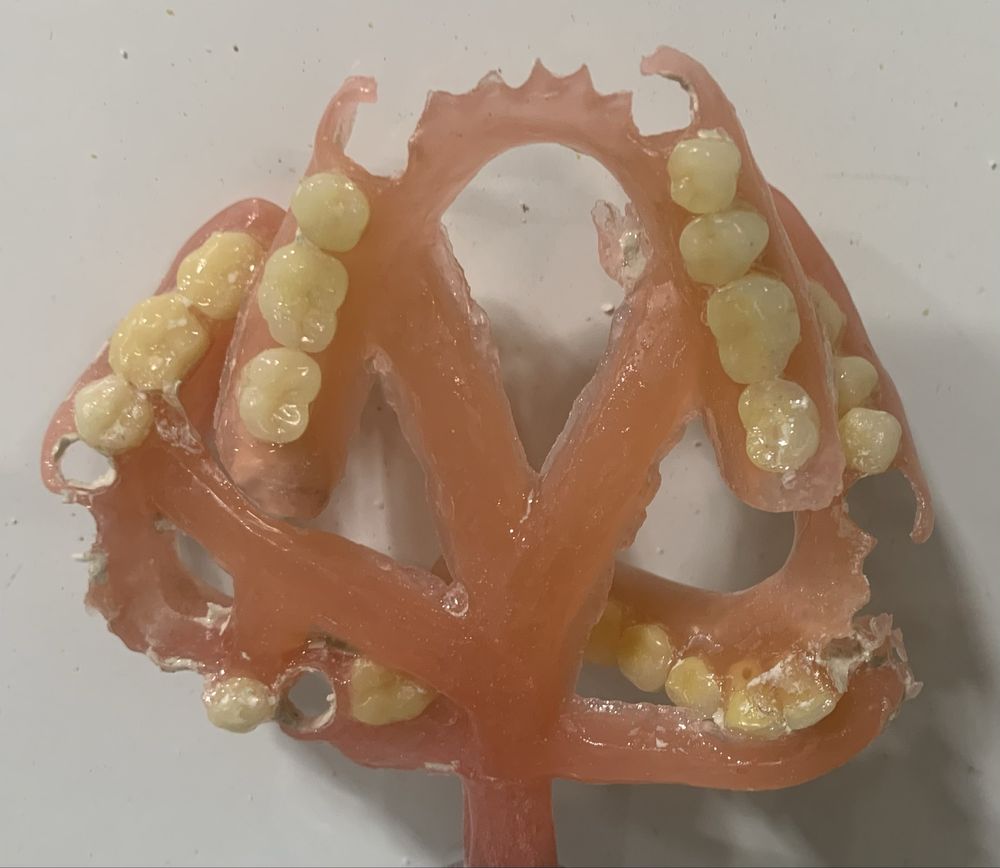 Инжекция Починка зубных протезов, Vertex Acron и Acetal