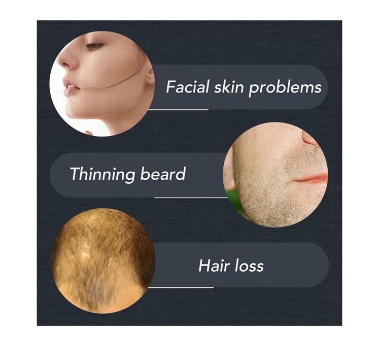 Derma Roller 1,5 mm, wałek z igłami do stymulowania brody i włosów