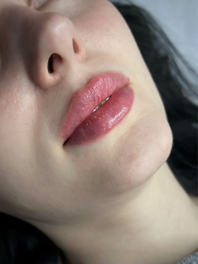 Увеличение губ от 1800! косметолог, ботокс био- мезо- Черкассы