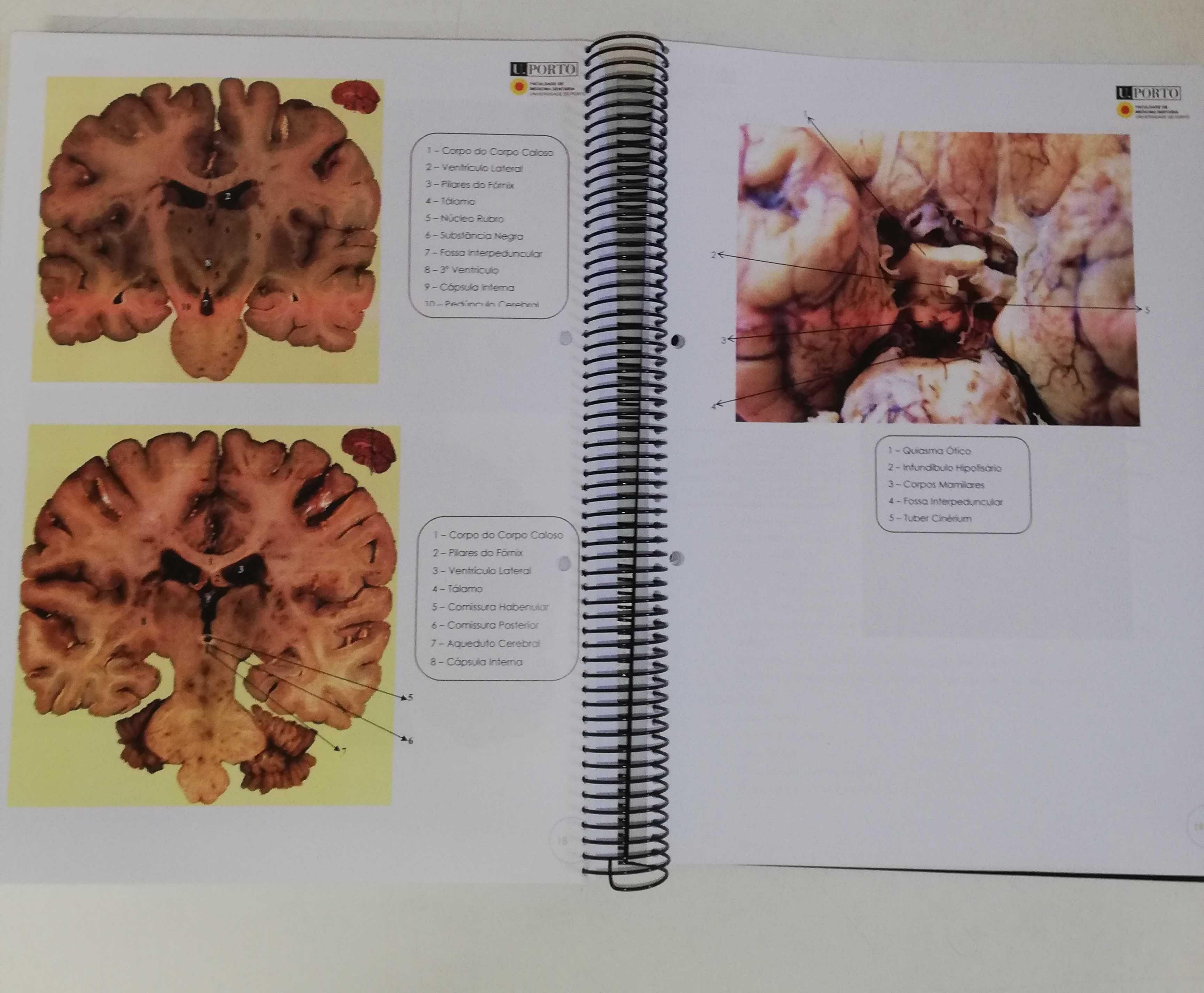 Atlas de Neuroanatomia