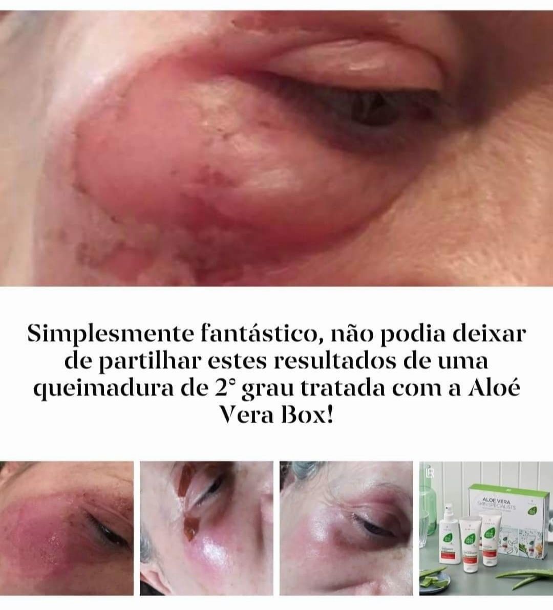 Box SOS Aloe Vera da LR nova e selada