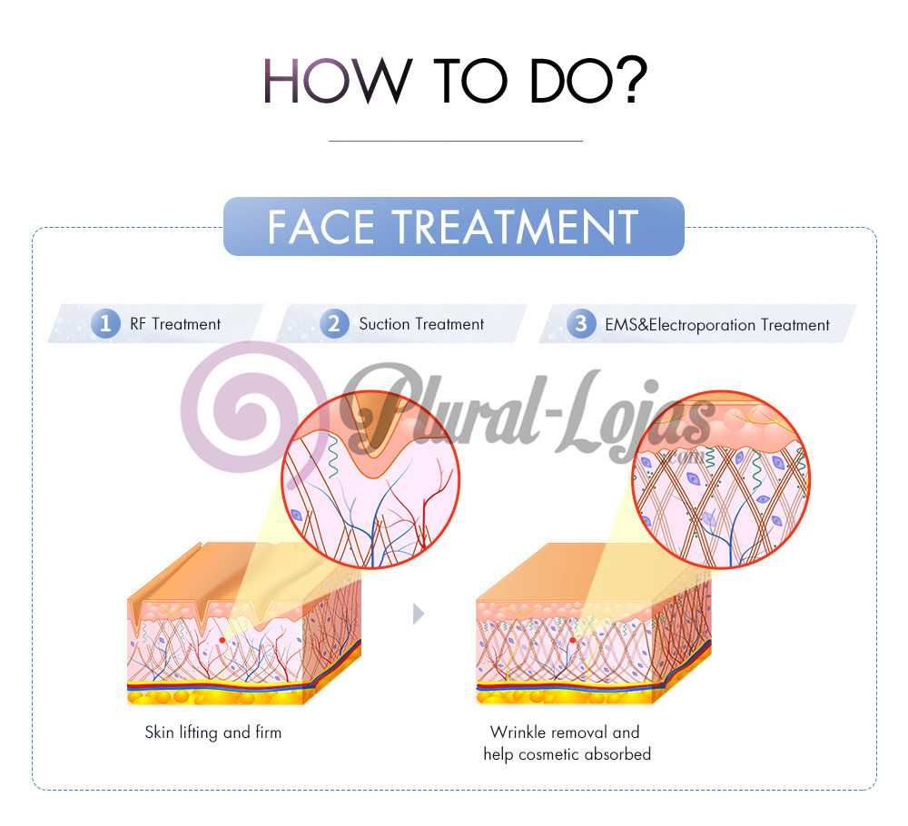 Maquina Cavitação S SHAPER +Radiofrequencia + Vácuo + Mesoterapia