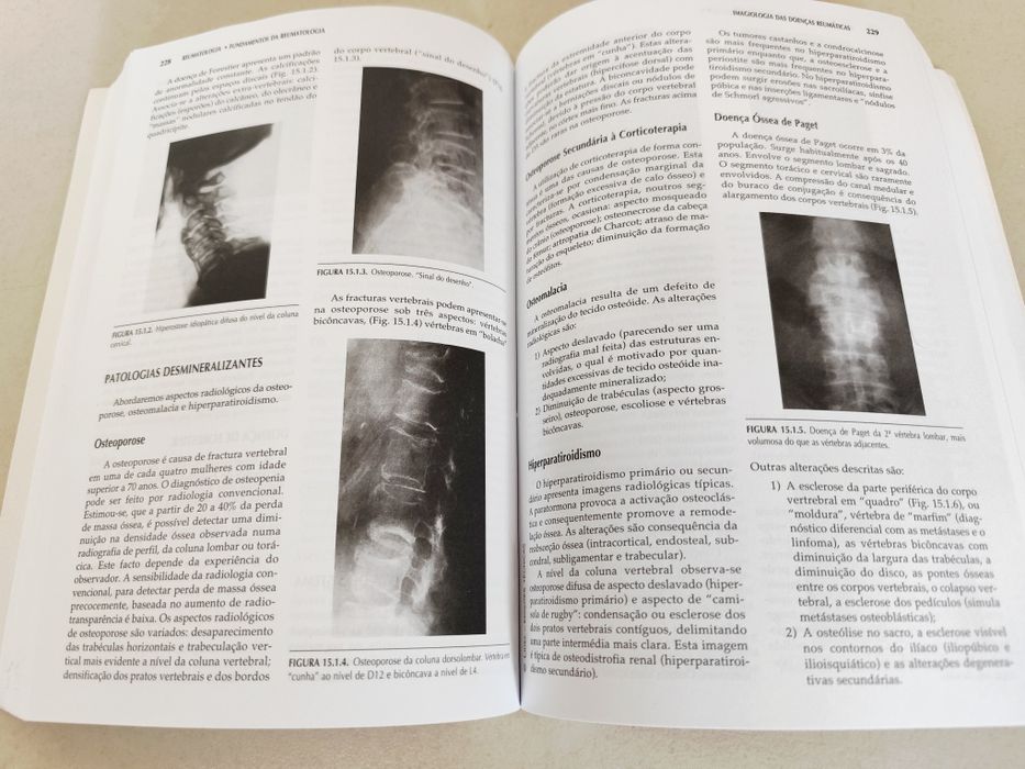 Livros Medicina: Reumatologia - Mário Viana de Queiroz (4 Volumes)