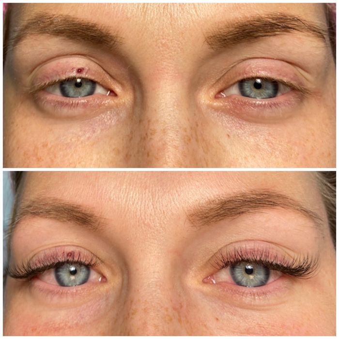 Обучение наращиванию ресниц.Увеличение губ.Ботулинотерапия.м.Гагарина