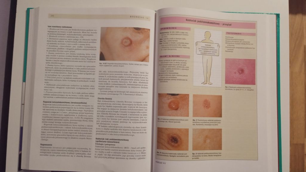 Książka pod tytułem Choroby wewnętrzne Tom 3.
