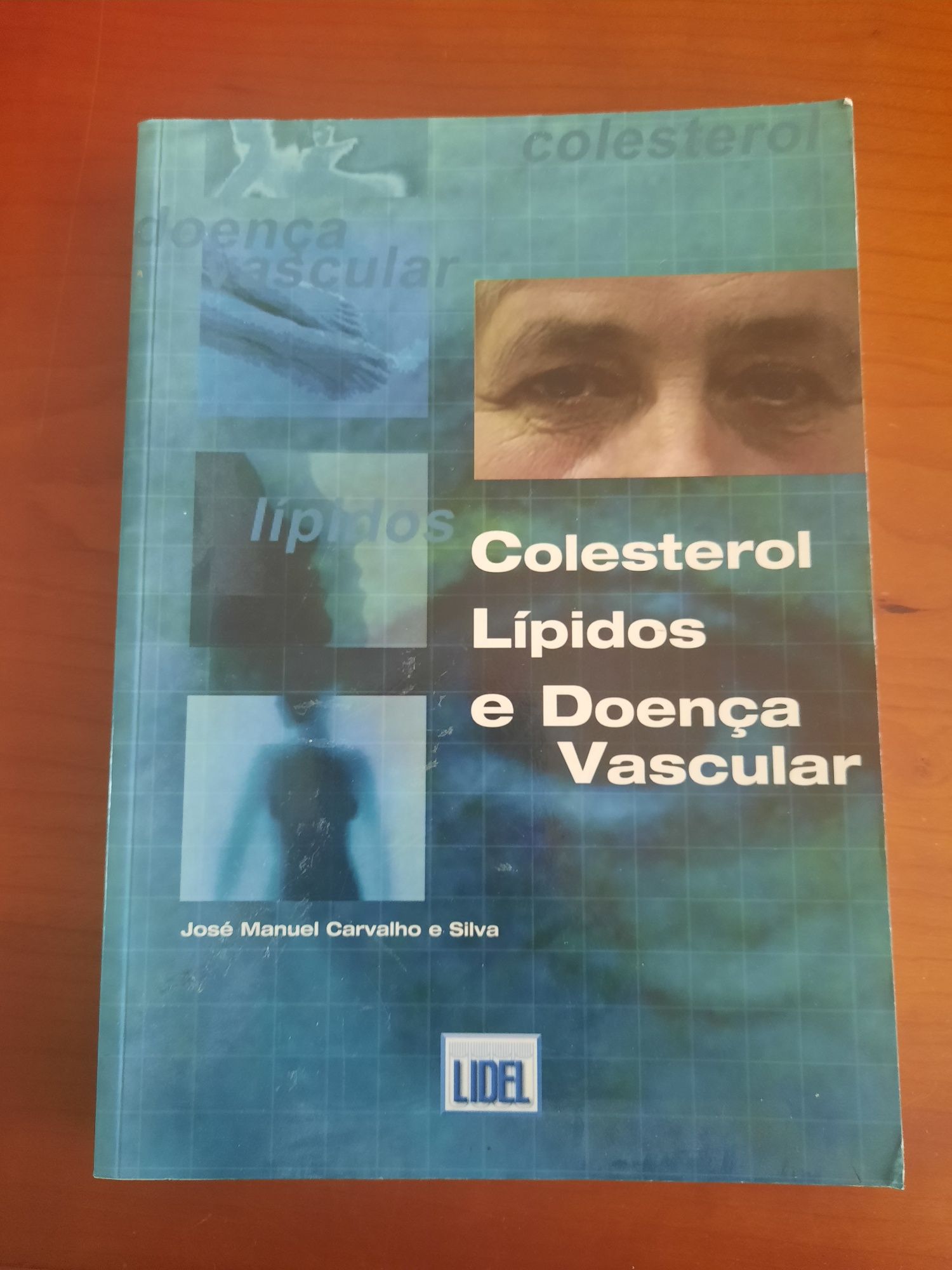 Colesterol,  Lipidos e doença Vascular José Manuel carvalho e Silva