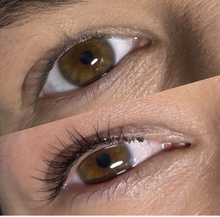 Наращивание, ЛаминированиеМасельского Хтз