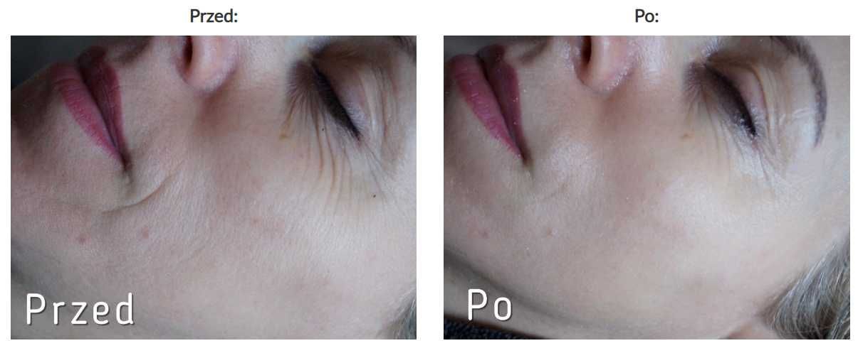 Maski ze złotem Souvre złote maski złoto koloidalne 3 szt lifting glow