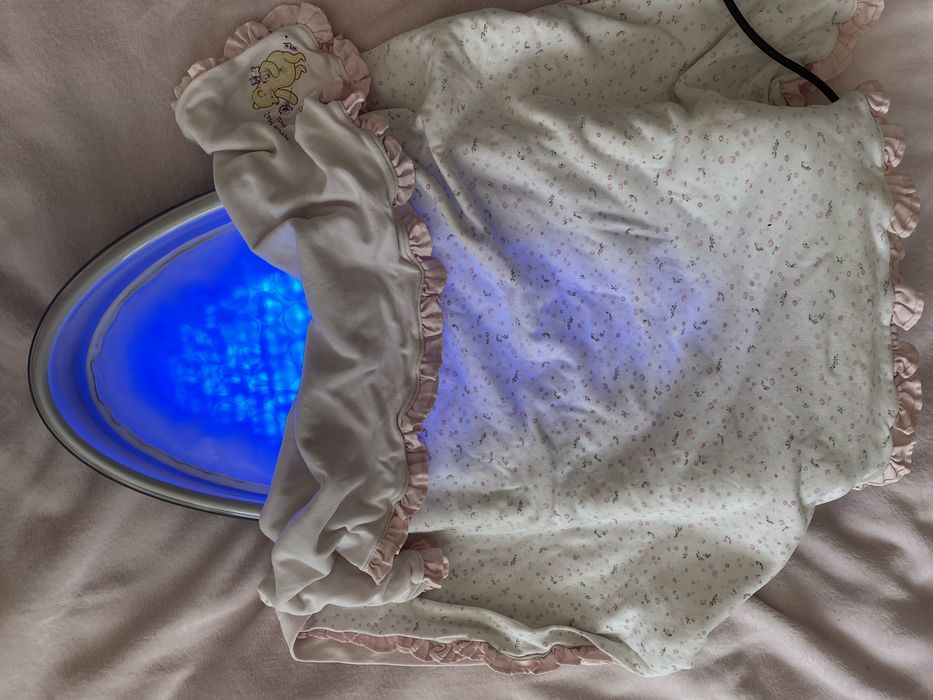 Лампа для лікування жовтухи (жовтяниці) у новонароджених