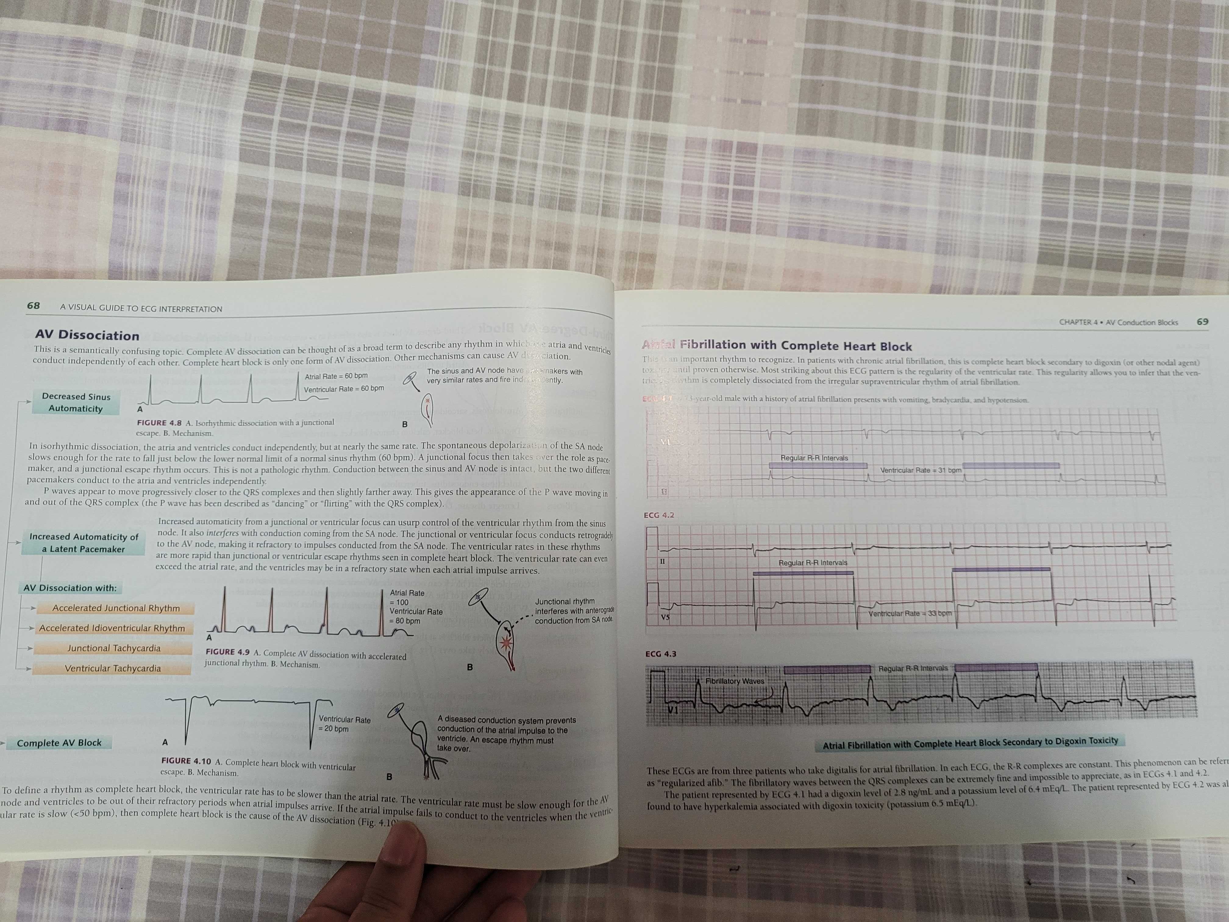 Medicina "A visual Guide to ECG interpretation" da Wolters Kluwer