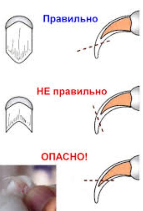 Когтерез набор или по отдельности.
