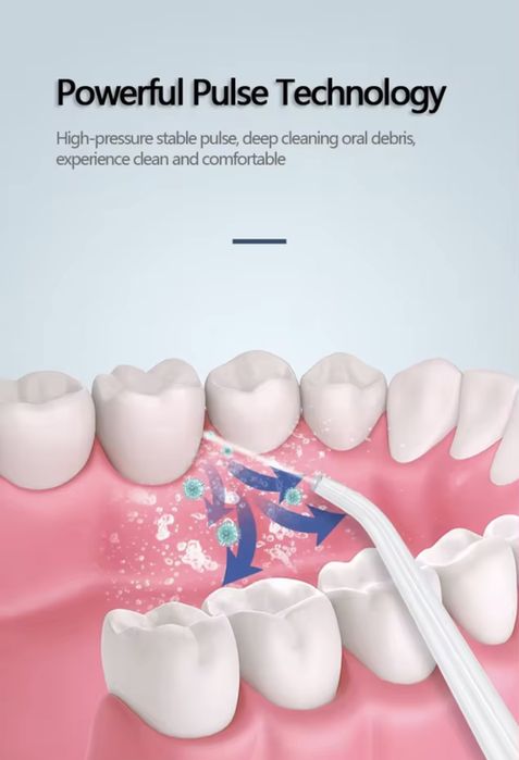 Іригатор,ірригатор,иригатор порожнини рота,зубів