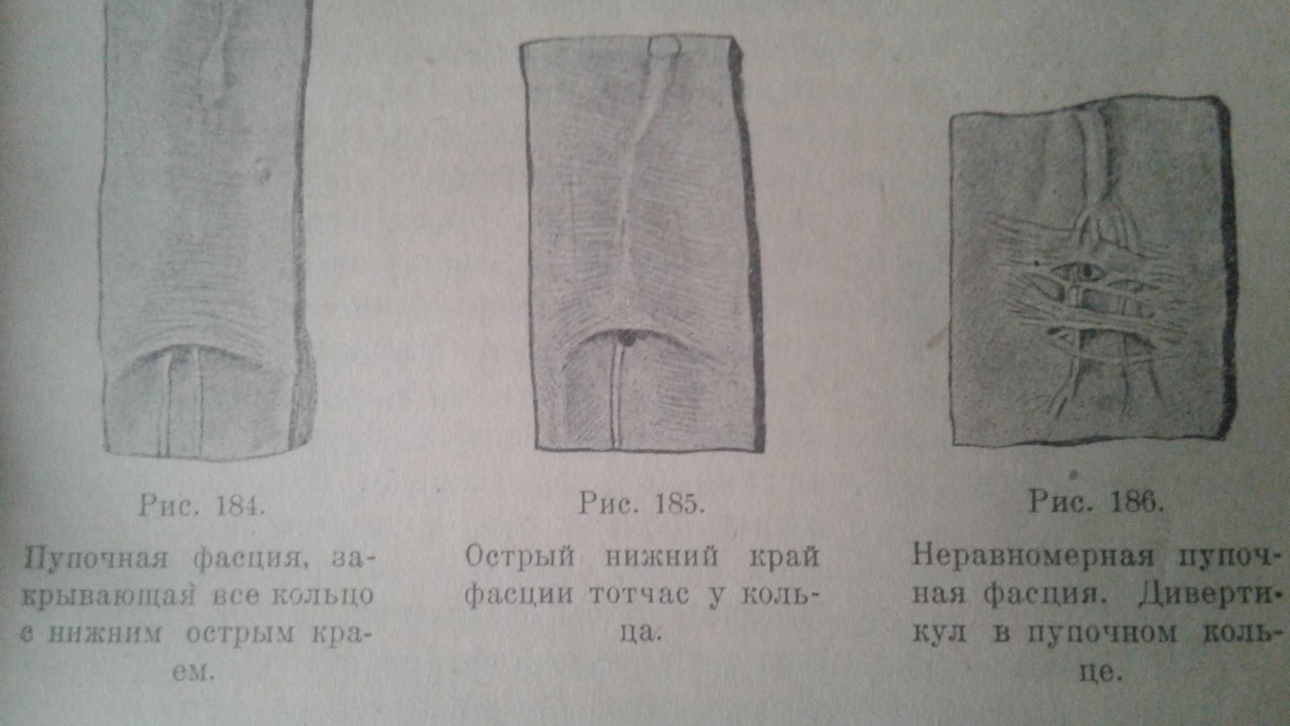 Топографическая анатомия 1925 год украинское издание