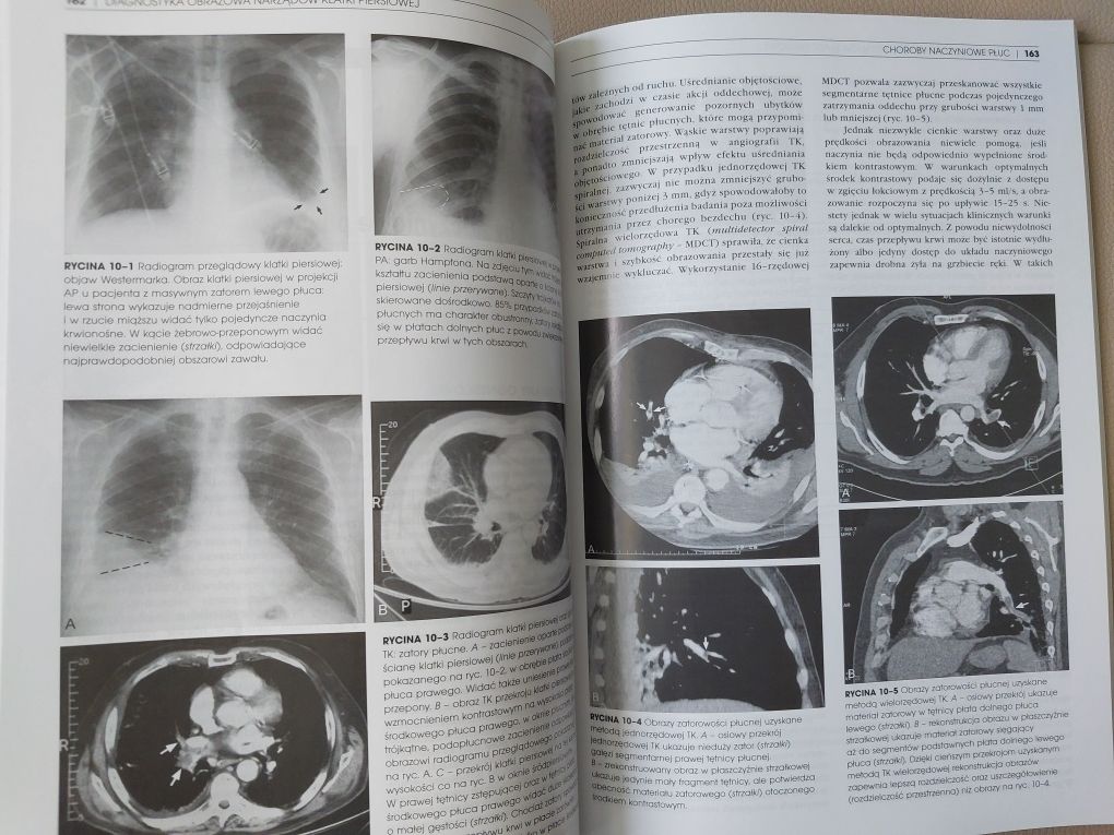 Diagnostka obrazowa narządów klatki piersiowej. Nowa.