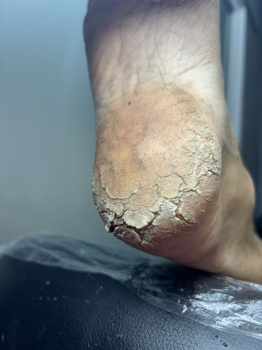 Дмитровка,Горишние плавни ,педекюр