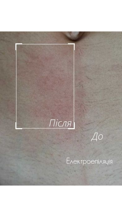 Косметолог, епіляція, корекція фігури