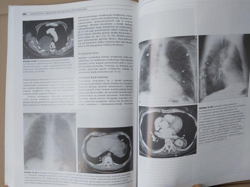 Diagnostka obrazowa narządów klatki piersiowej. Nowa.