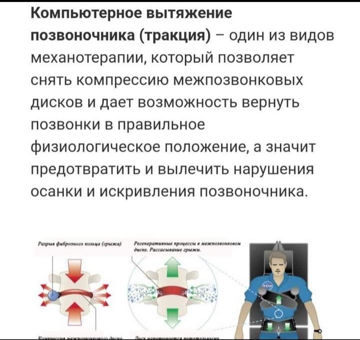 Вытяжение позвоночника лечение тракция зменшення болю відновлення хрящ