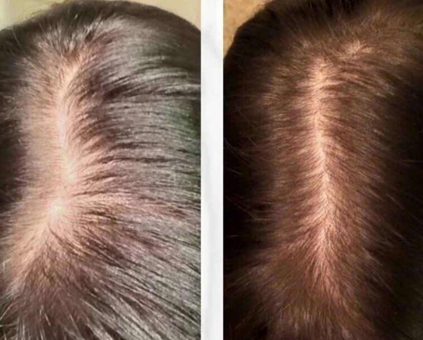 Увеличение губ - 1600. Колличество мест ограничено!