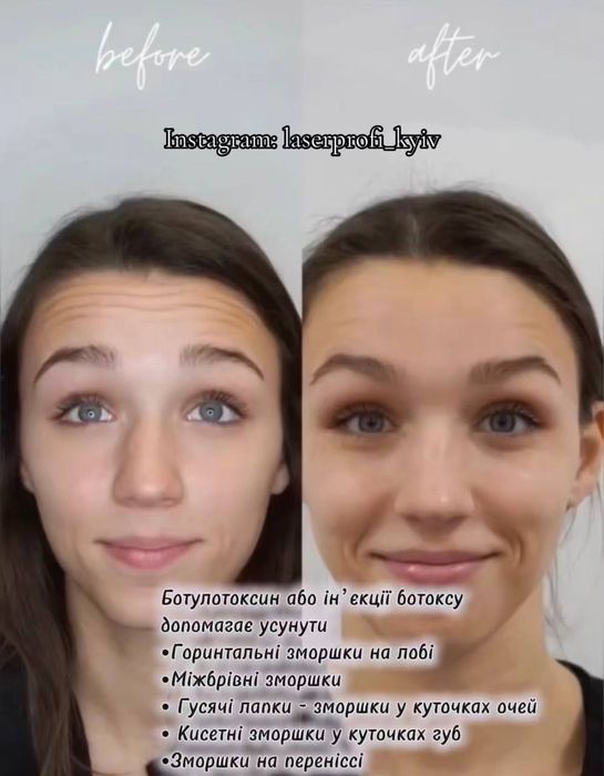 Косметолог Харківський рн.метро Вирлиця