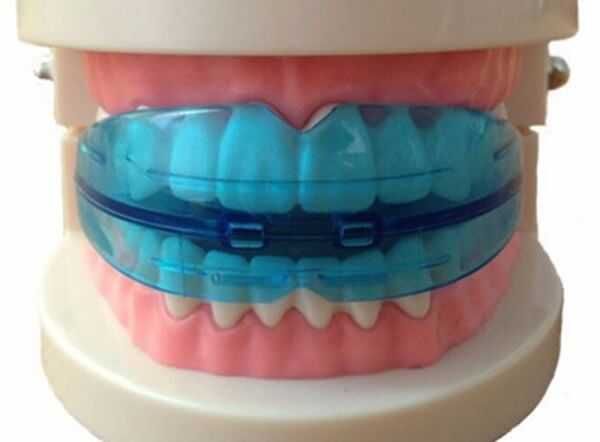 Капа для выравнивания зубов трейнер ортодонтический