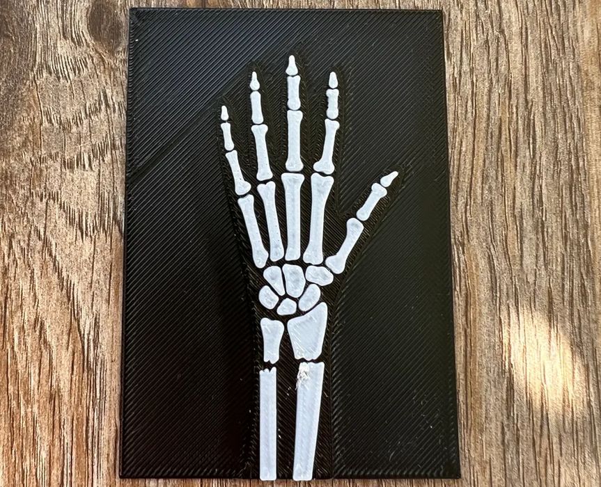 Raio-X de Mão Pequeno