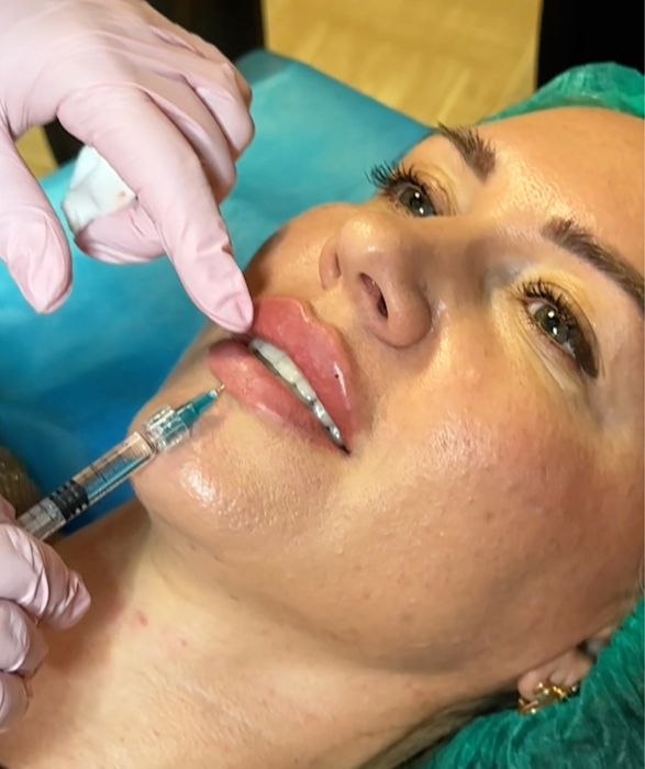 Косметолог  в Миколаєві губи, RF- ліфтинг, ботокс