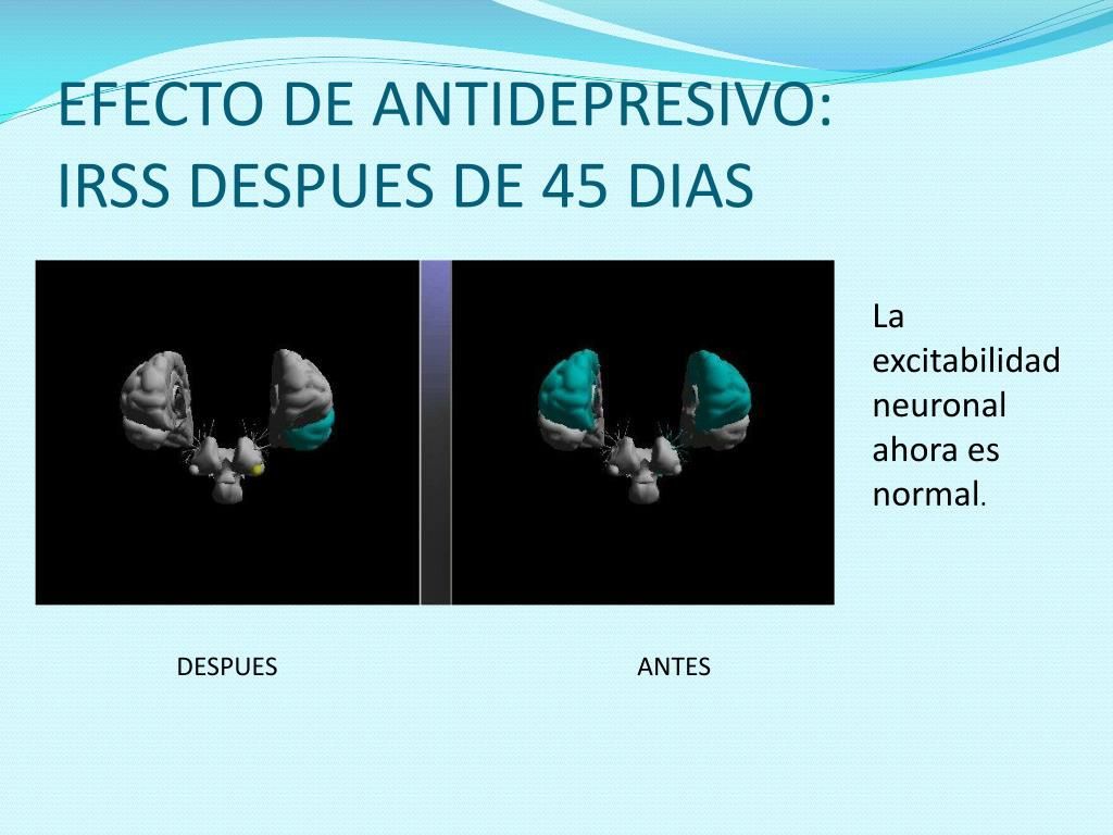 Biorressonancia - EIS (Eletro Intersticial Scan) - Aparelho de Diagnós