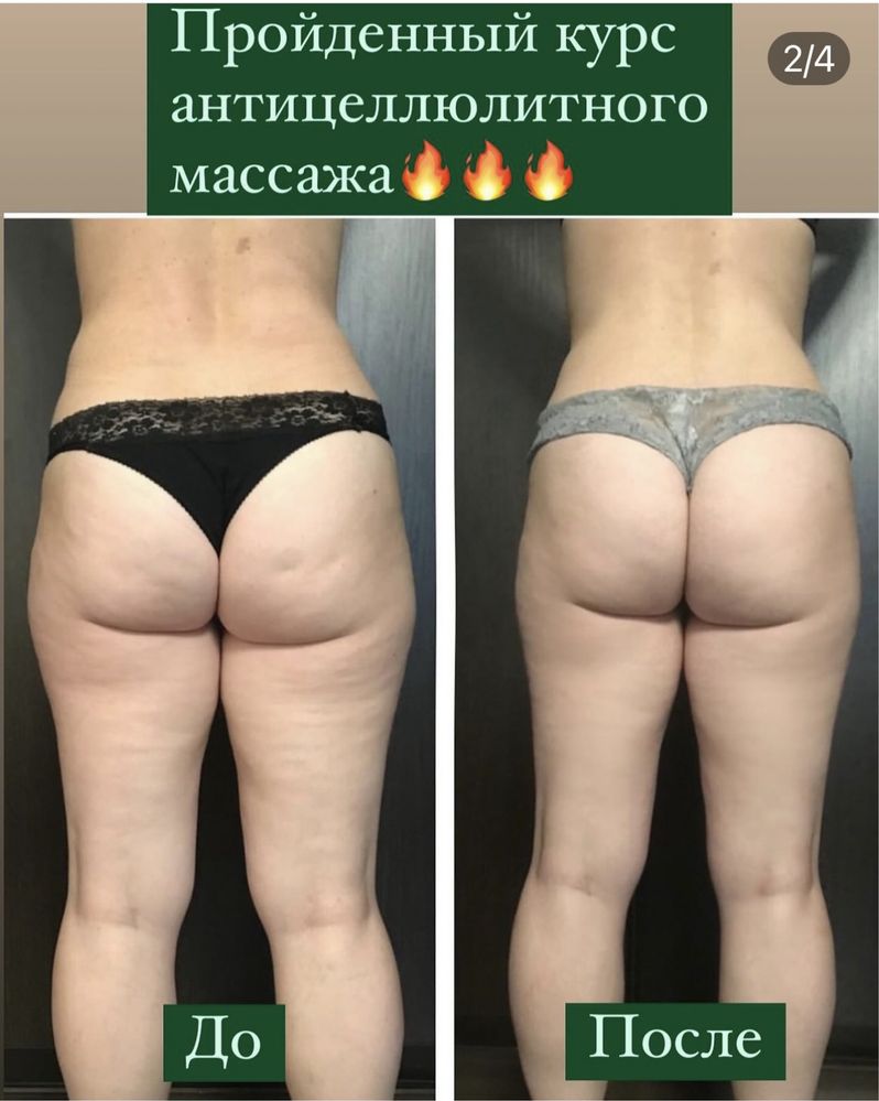 Массаж эпиляция. Улица Гурова 17 ,салон Подиум