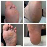 Pedicure hybrydowy /  podologiczny wolne terminy Kraków