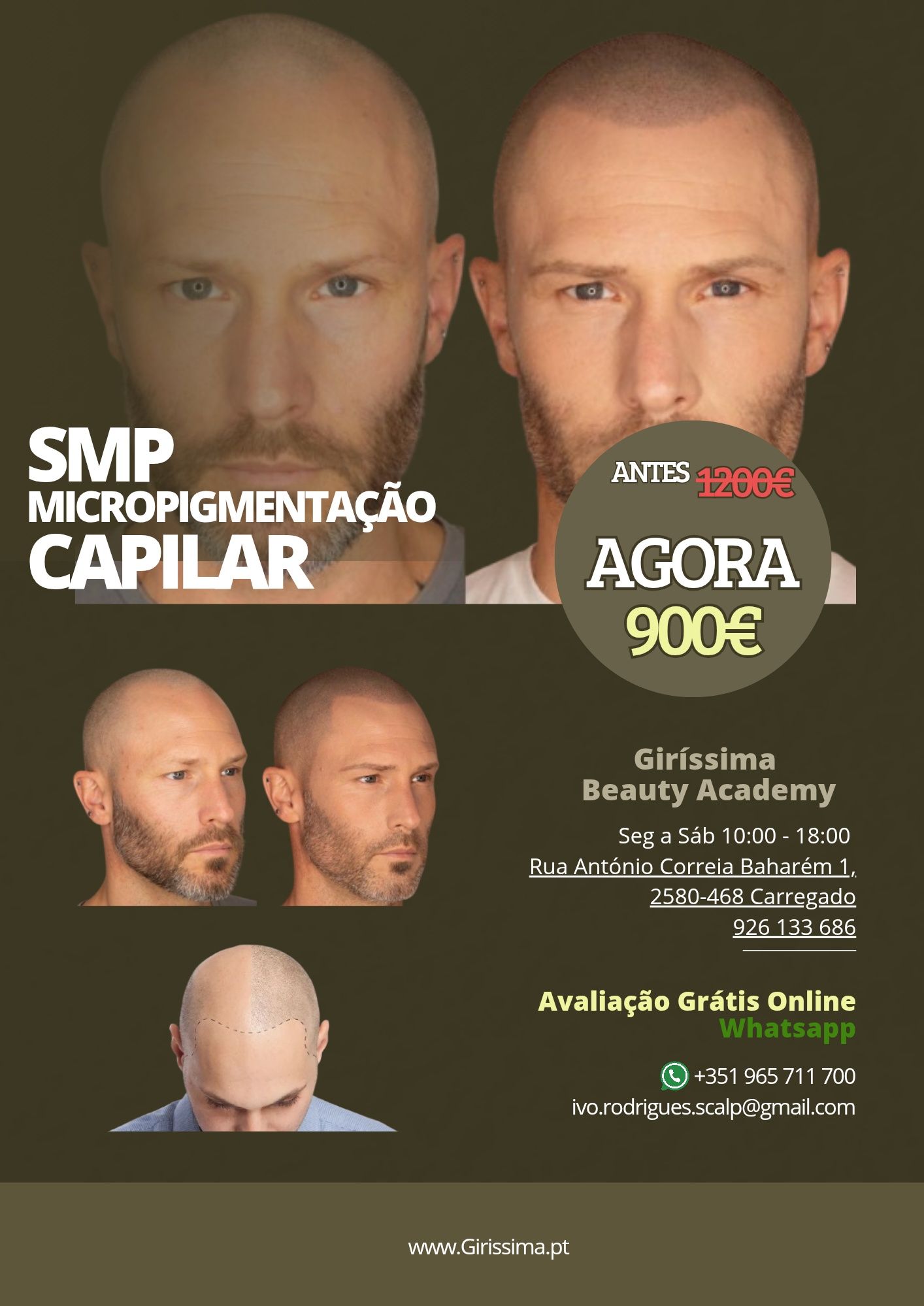 Micropigmentação Capilar