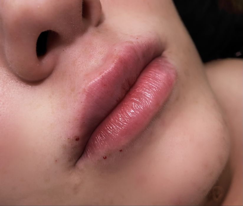 Аугментація обличчя