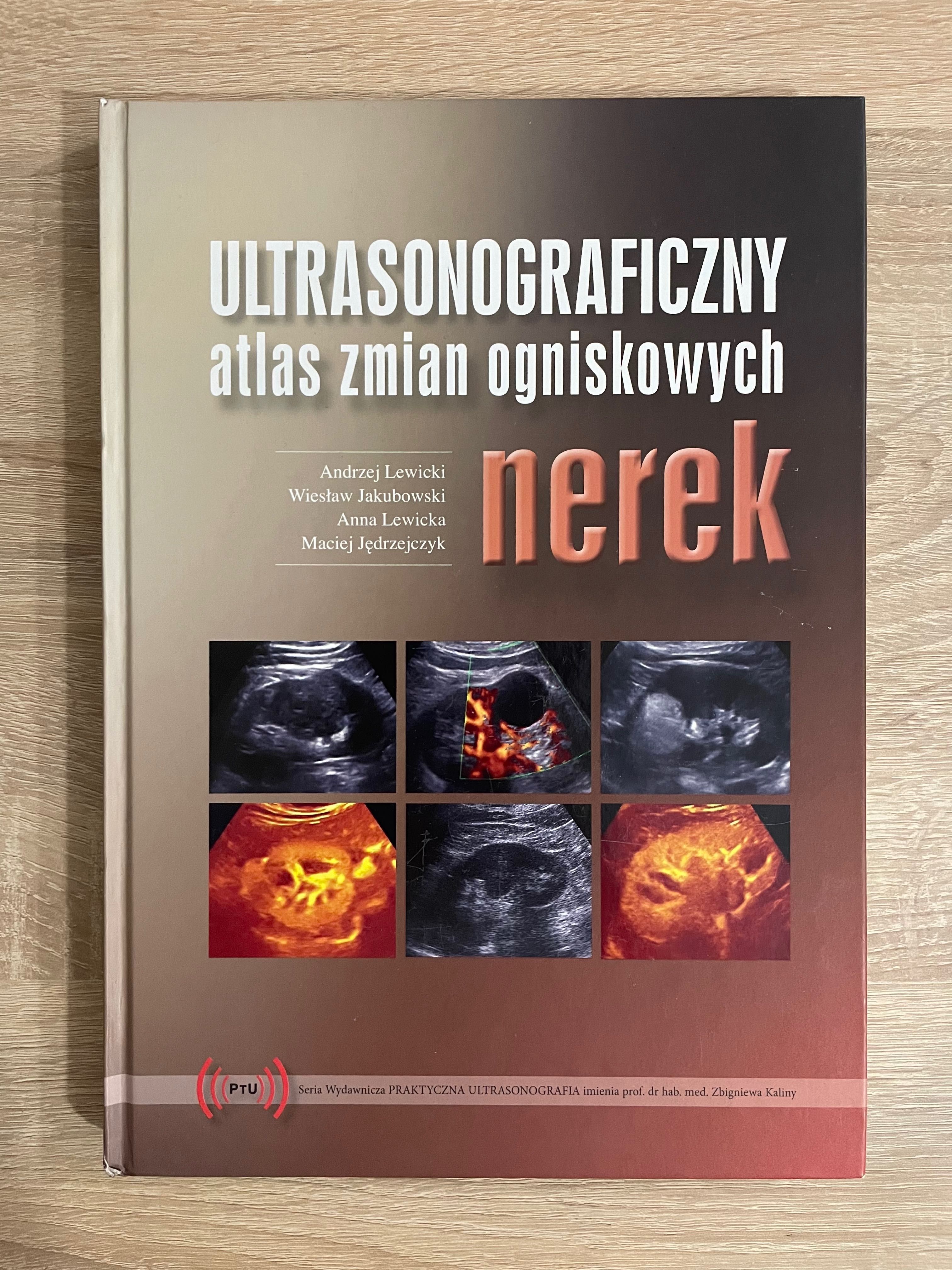 Ultrasonograficzny atlas zmian ogniskowych nerek Jakubowski radiologia