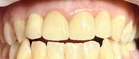 Стоматолог. Ак. Вильямса 56а!! Все виды протезирования и лечения зубов
