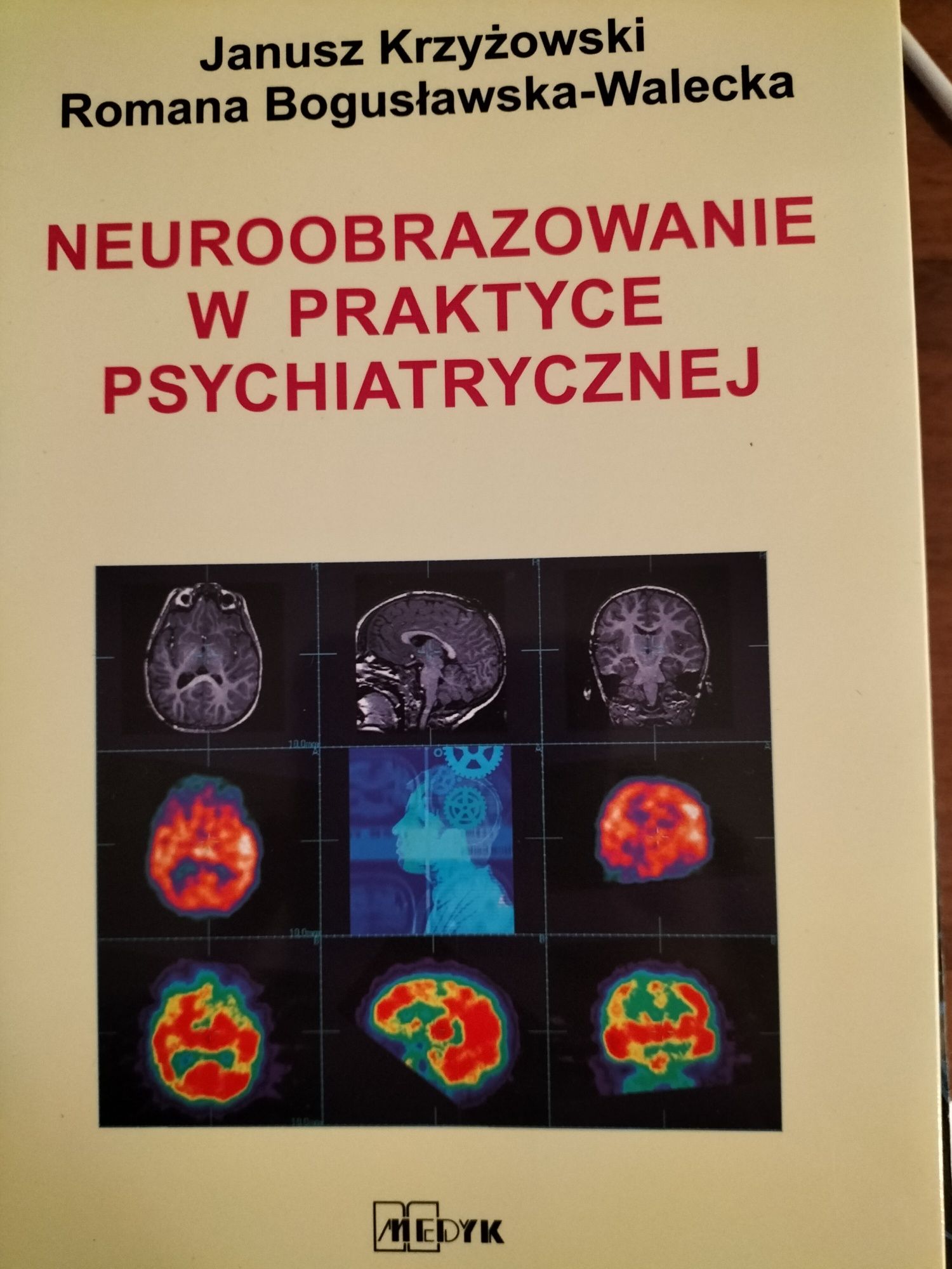 Neuroobrazowanie w praktyce psychiatrycznej
