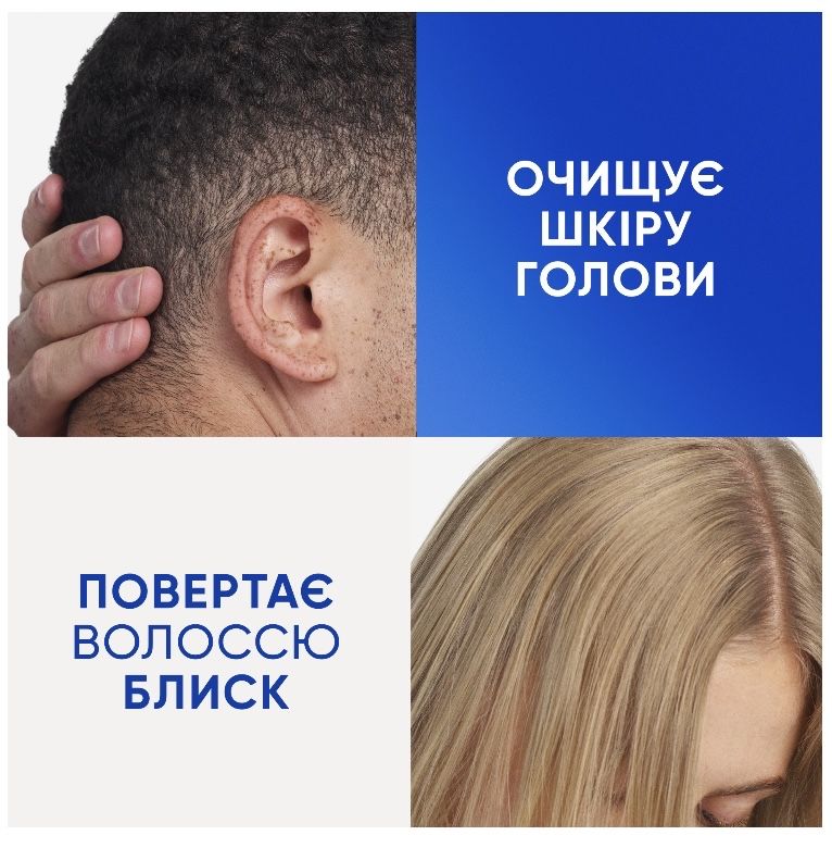 Шампунь проти лупи Head & Shoulders Classic 400мл (хеденшолдерс)