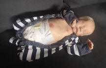 Reborn płytka brzuszna