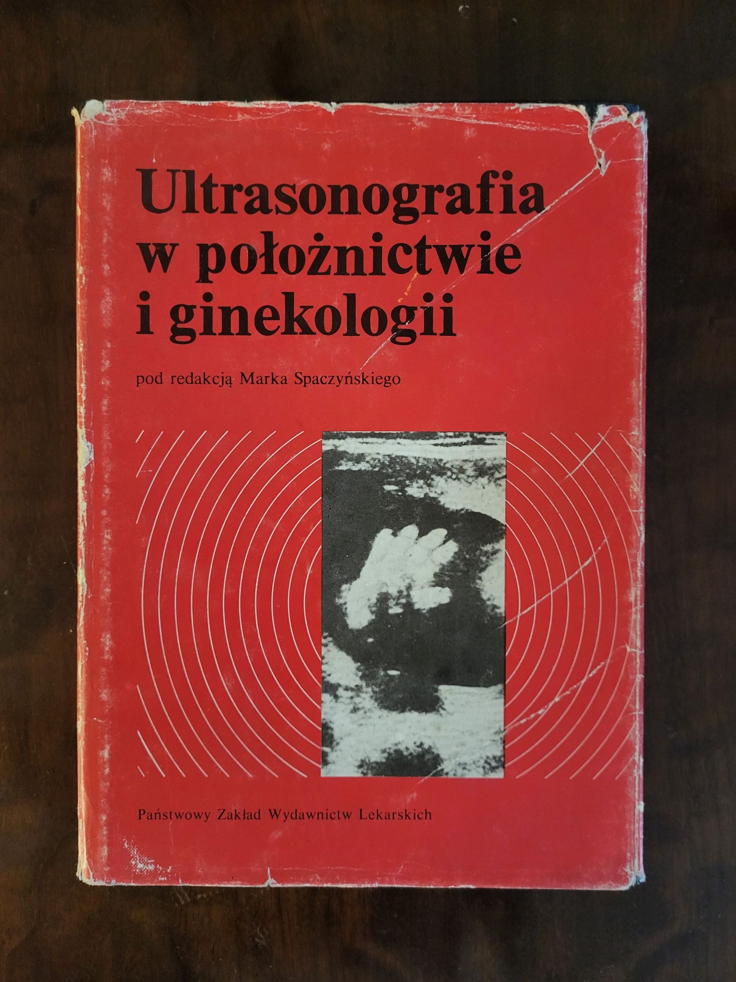 Ultrasonografia w położnictwie i ginekologii