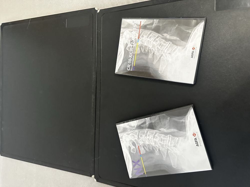Agfa CR 10-X skaner RTG