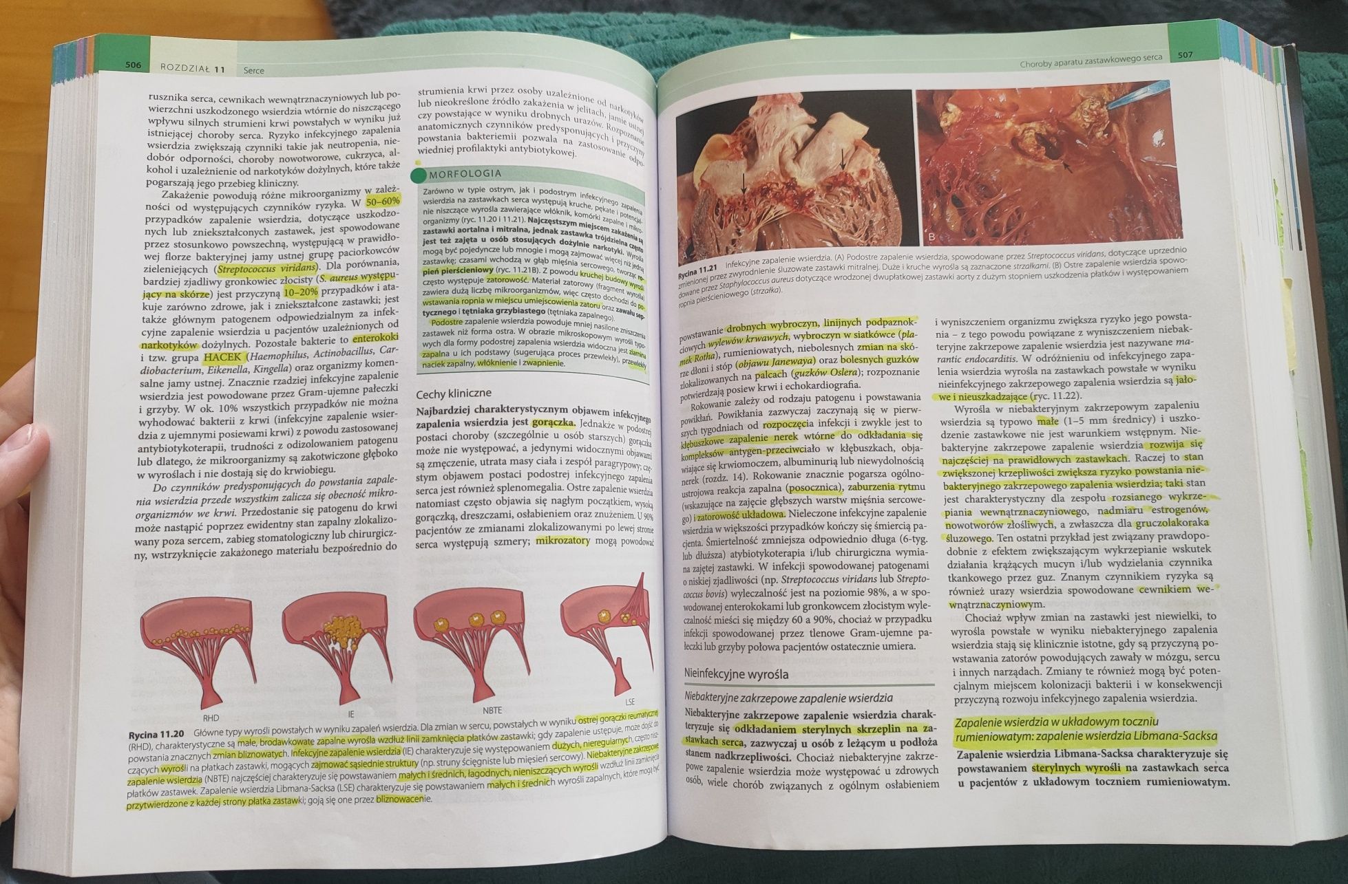 Robbins Patologia Wydanie X
