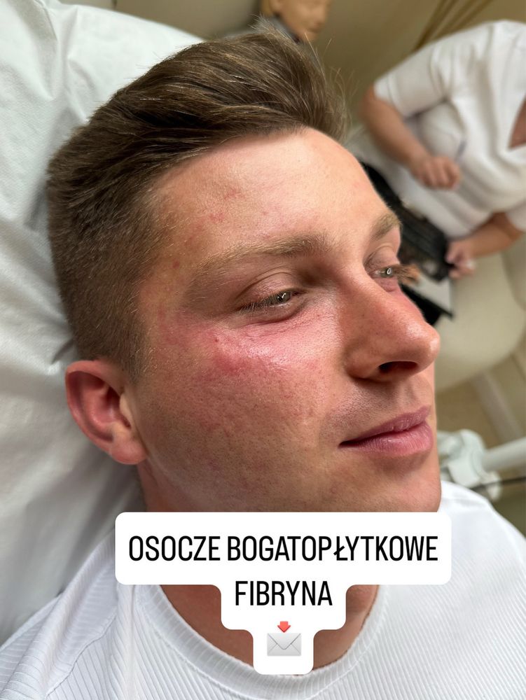 Medycyna estetyczna,przedłużanie włosów.