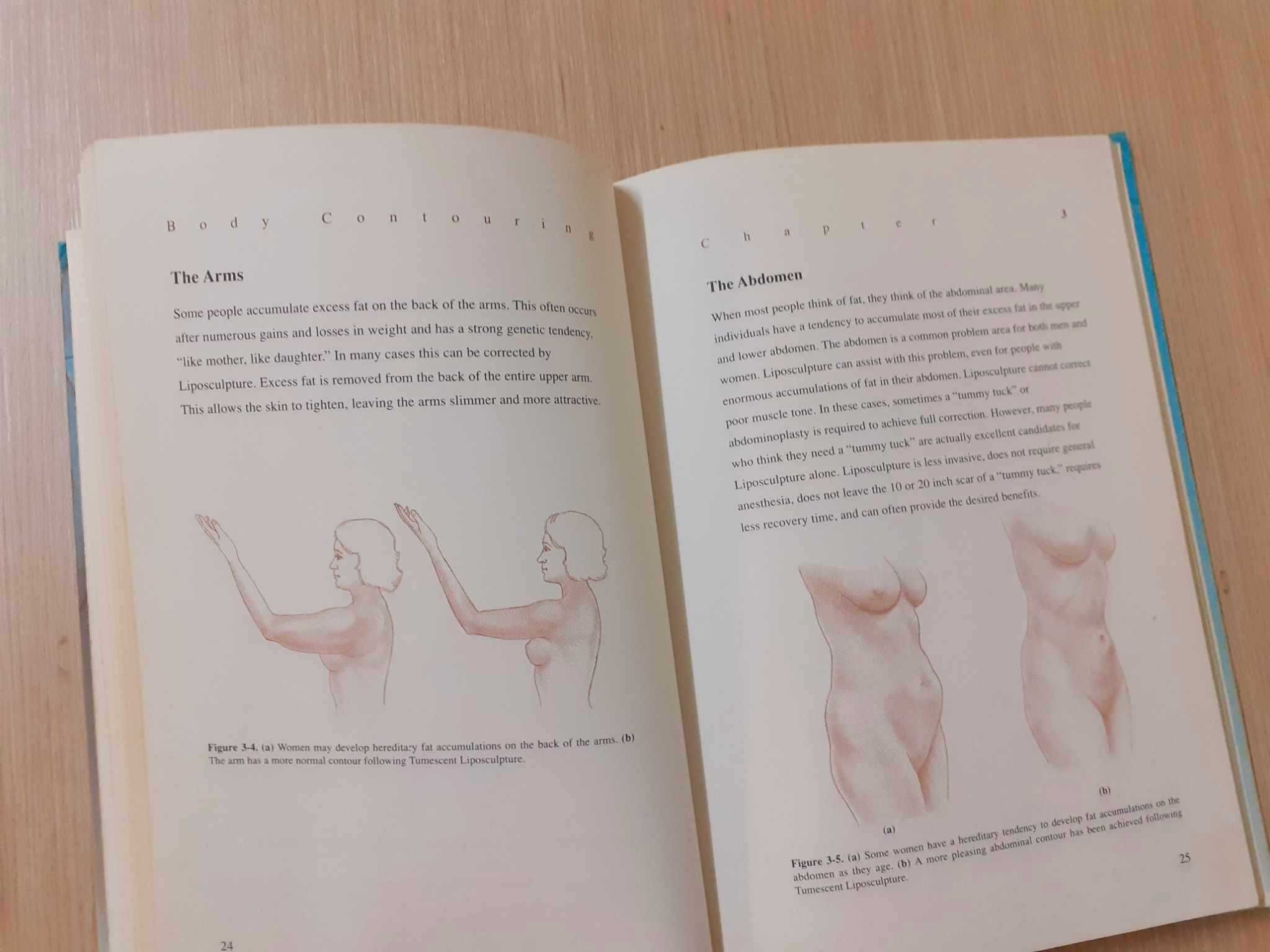 Body Contouring: The New Art of Liposculpture
