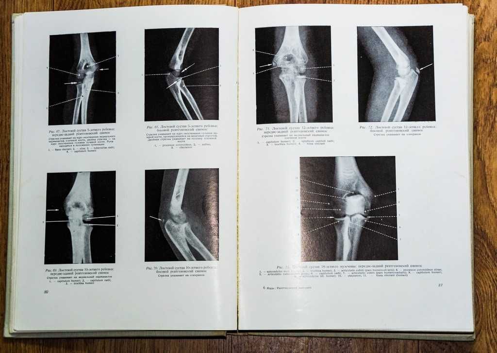 Рентгеновская анатомия 1961г.