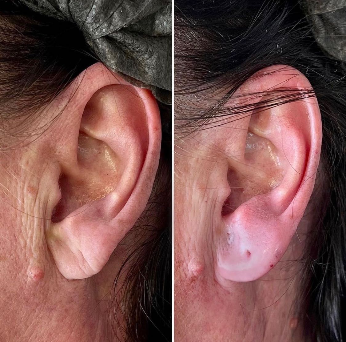 Botox/fullFace/контурная пластика/ губы