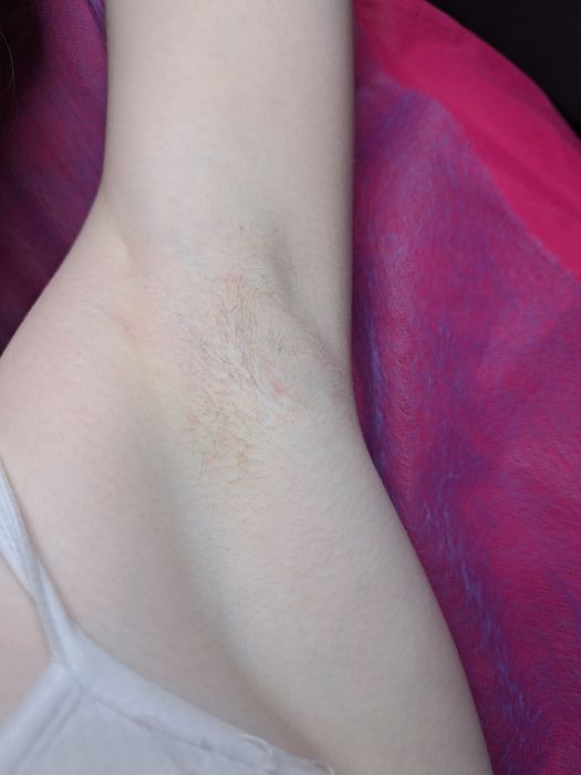 Шугаринг Кривий Ріг