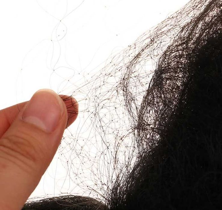 Rede  6Mt - 8Mt - 10Mt