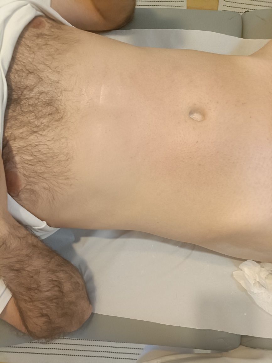 Depilação Masculina