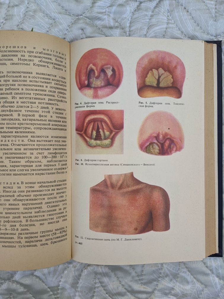 Детские инфекционные болезни, С.Д.Носов, 1982 г.