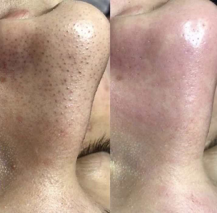 Косметолог,досвід  11 років.