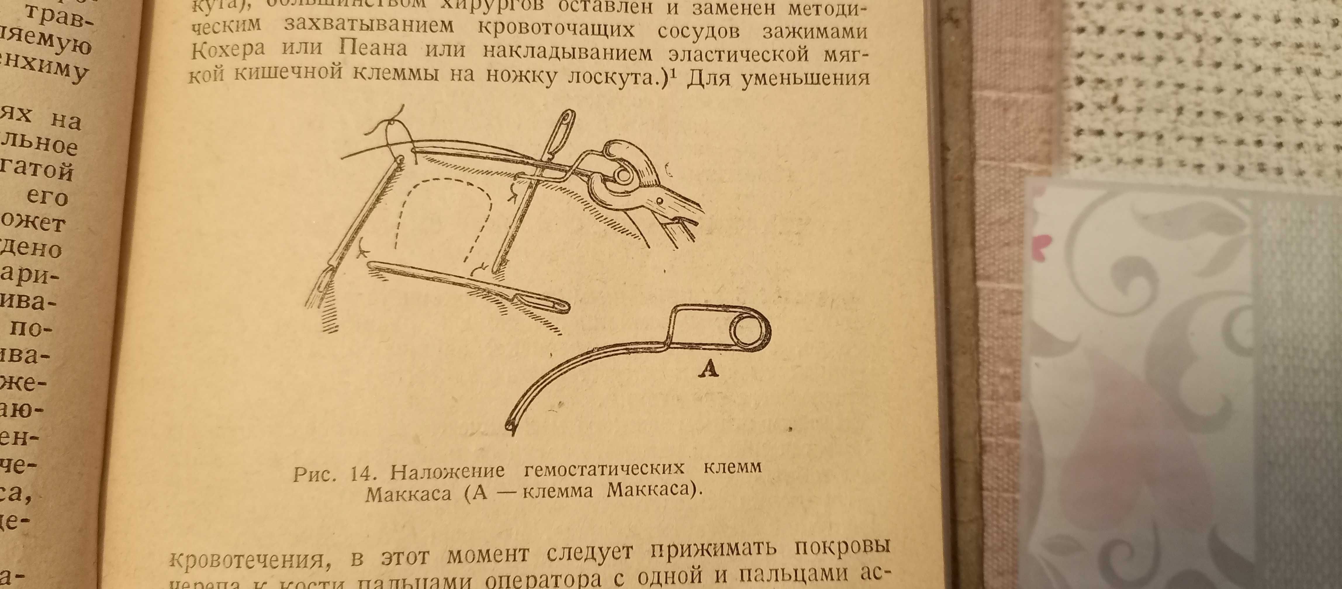 Левитский В.П., Кровотечение и методы его остановки. Книга, 1942 год.